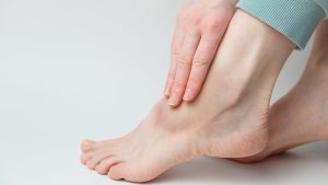 Miksi toistuvat mustelmat voivat viitata C-vitamiinin puutteeseen