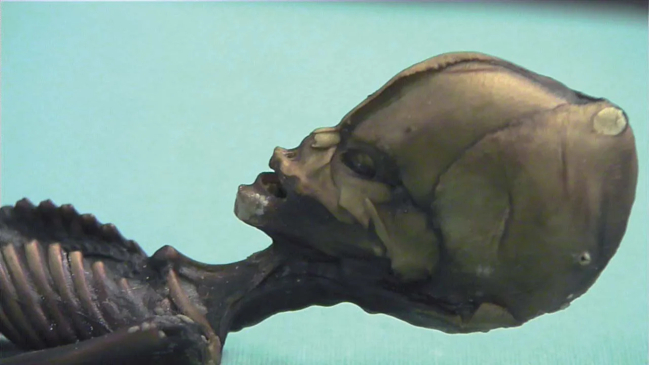 Atakanan esihistorialliset muumiot sisältävät epätavallisen anatomisen yksityiskohdan: se selittää aivojen kutistumisen tuhansien vuosien elämän jälkeen autiomaassa.