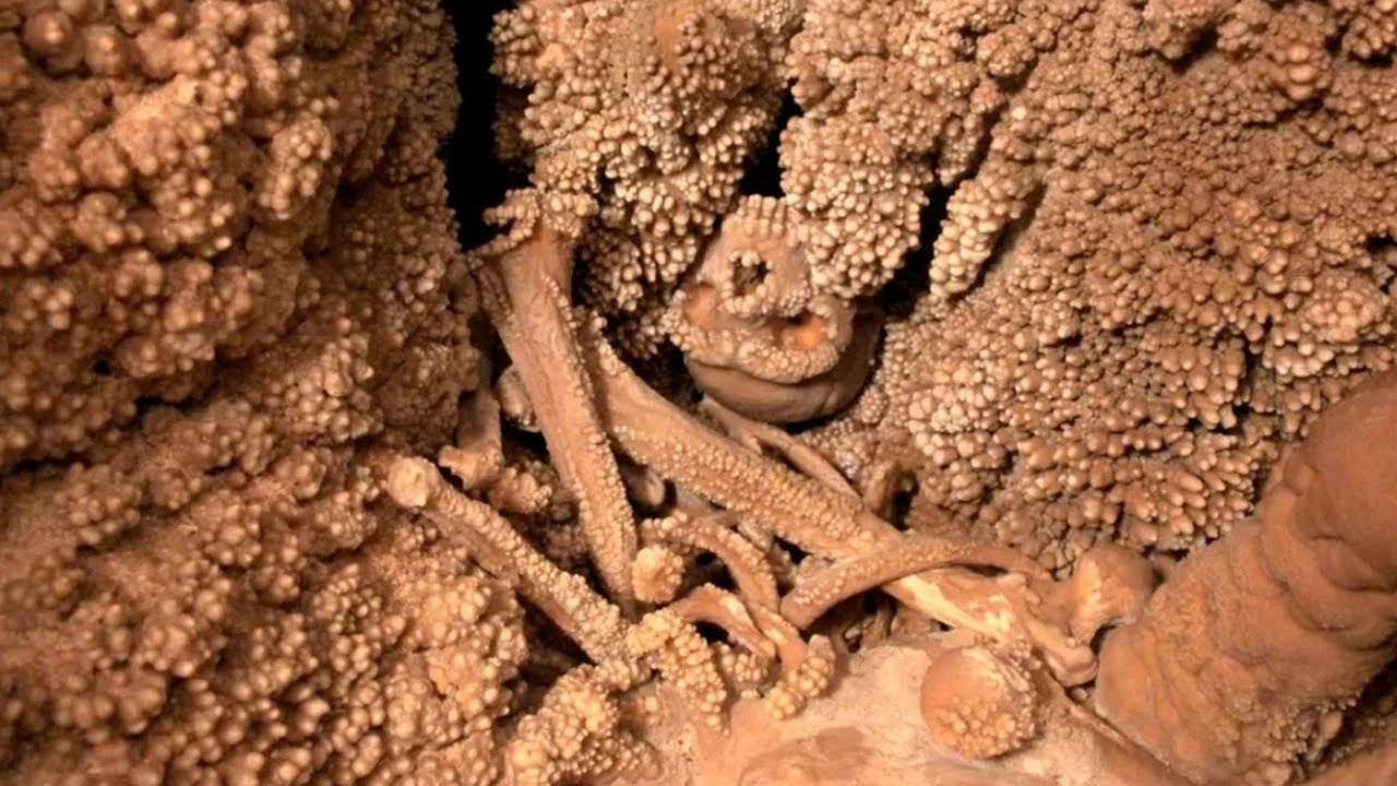 Yli 12 000 vuotta maan alla: tutkijat ovat löytäneet ihmisen vanhimman rekisteröidyn geneettisen sairauden.