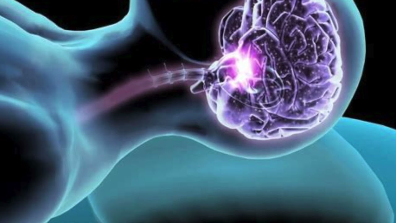 Univaje heikentää neuronien suojatoimintoja ja heikentää kognitiivisia toimintoja.