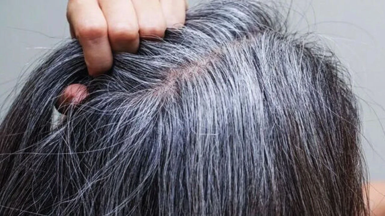 Mitkä ovat etikan ja ruokasoodan käytön edut harmaille hiuksille, ja miten sitä käytetään oikein?